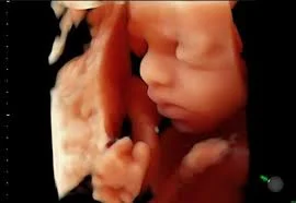 Imagens 3D e 5D